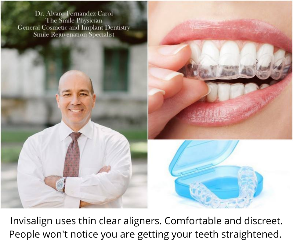 Invisalign use thin, clear, comfortable and discrete aligners 