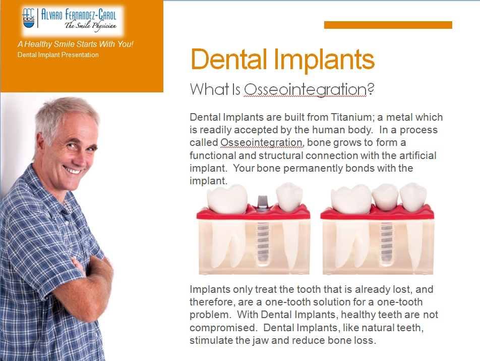 dental implants what is osseointegration
